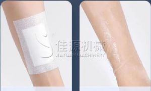 Application of Hot Melt Adhesive in Medical Products
